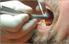 Dentiste et soins dentaires en Hongrie