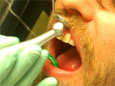 Soins dentaires en Hongrie, Pays-bas et Turquie