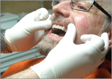 Controle des couronnes dentaires