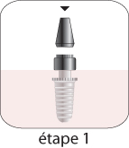 Implants dentaires Hongrie