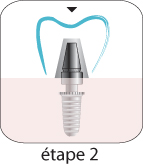Implants dentaires Hongrie