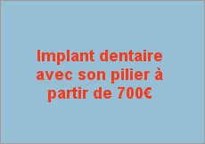 Prix implant dentaire